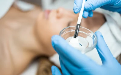 Revelando la Belleza Natural: Peeling Químico Superficial