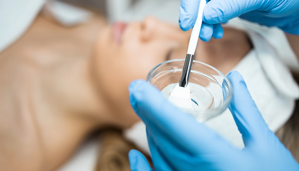 Revelando la Belleza Natural: Peeling Químico Superficial
